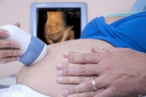 Ett kommande liv: en mors kärlek för sitt ofödda barn