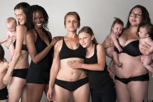 5 tips för att återhämta sig från diastas