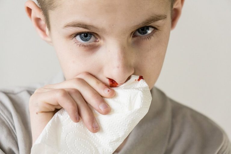 Näsblod hos barn: orsaker och behandling