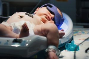Gulsot hos bebisar - symtom och behandling