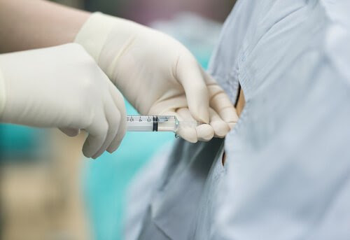 Ambulatorisk epiduralbedövning och dess påverkan