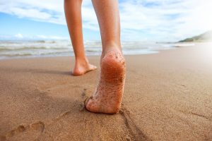 Hur man korrigerar hjulbenthet hos barn