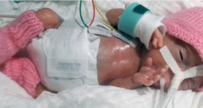 för tidigt född bebis