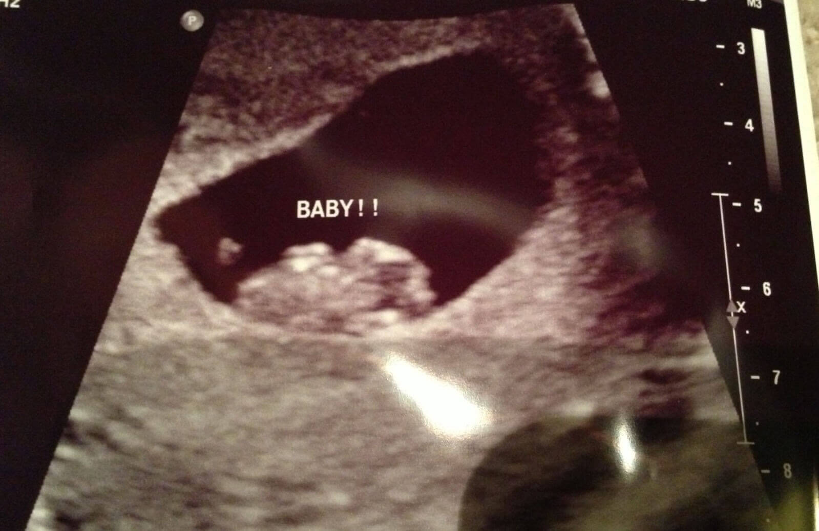 Ramzi-metoden för att ta reda på ditt barns kön