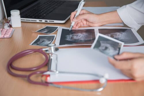 läkare tittar på ultraljudsbilder