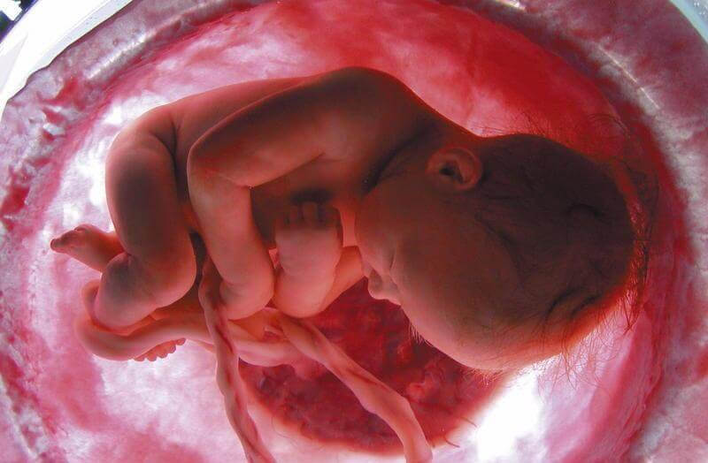 navelsträngsprolaps: foster i livmodern