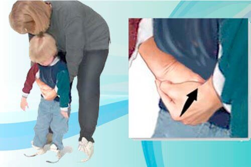 En kvinna utför Heimlichmanövern på ett barn.
