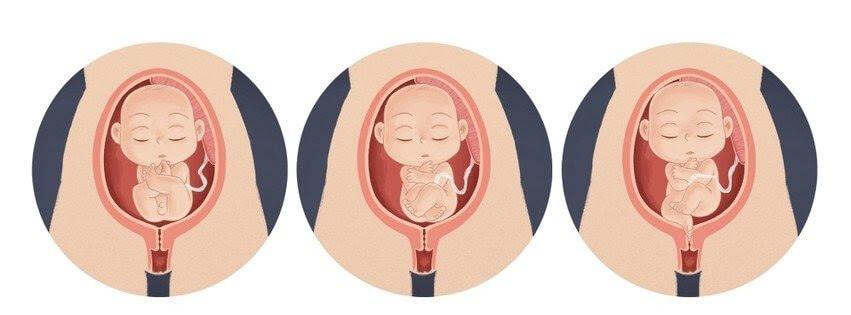 illustration av barn i sätesbjudning