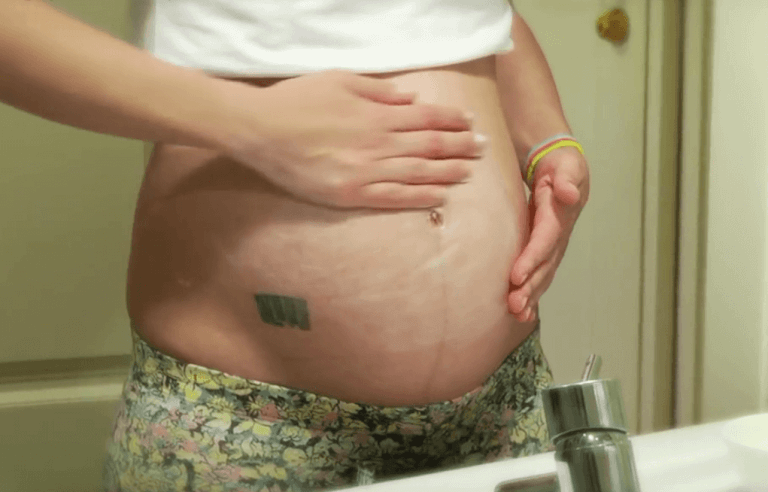 Kvinna som är gravid.
