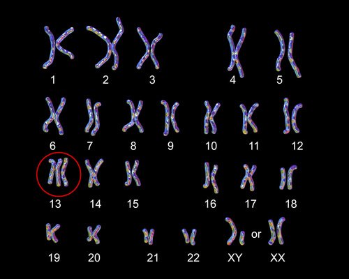 Kromosomkarta för Pataus syndrom