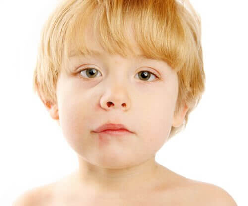 Munsår hos barn: pojke med munsår