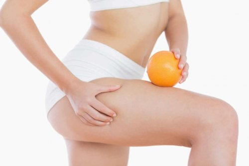 celluliter efter graviditeten: kvinna med apelsin