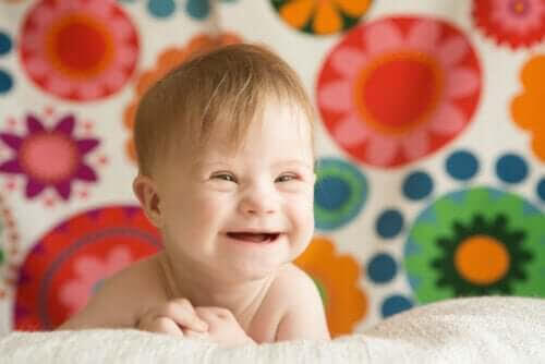 skrattande baby med Downs syndrom