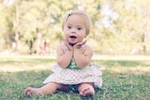 En liten flicka med downs syndrom.