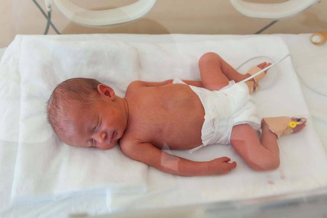 matsmältningsproblem hos för tidigt födda barn: prematur baby