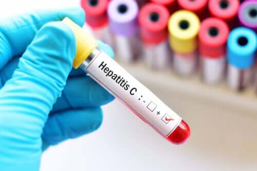 Hepatit C under graviditeten