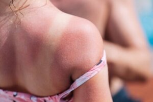 Solbränna hos barn: varför är det så farligt?