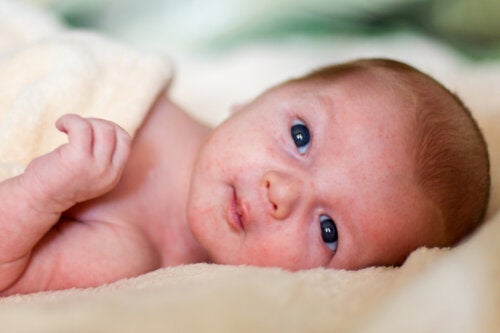 Hudutslag hos spädbarn: vad du bör veta