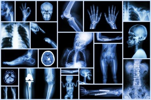 Röntgen för barn: vad du behöver veta