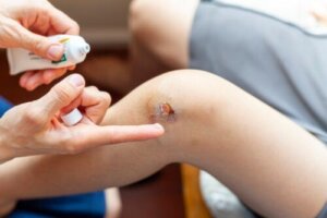 Hur man behandlar infekterade sår hos barn