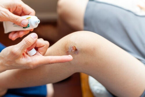 Hur man behandlar infekterade sår hos barn