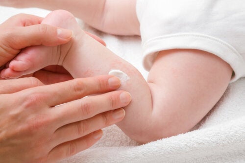10 naturliga botemedel för torr hud hos spädbarn