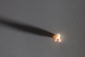 Förlust av en mjölktand i förtid: orsaker och konsekvenser