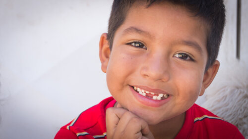 Vad du bör veta om dental agenesi hos barn