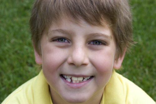 Mitt barns nya tänder är gula, är detta normalt?