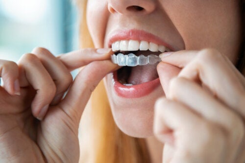 Hur man rengör avtagbara tandställningar