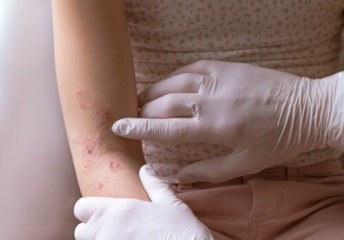 De 10 vanligaste hudproblemen under det första levnadsåret