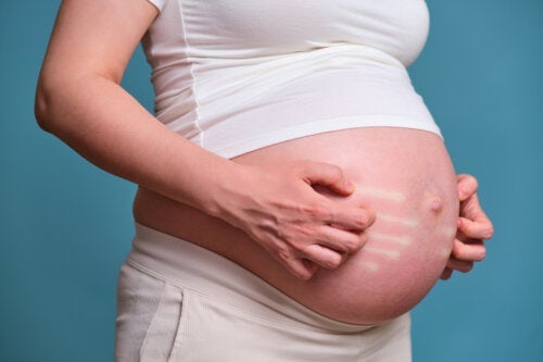 Hudallergier under graviditeten